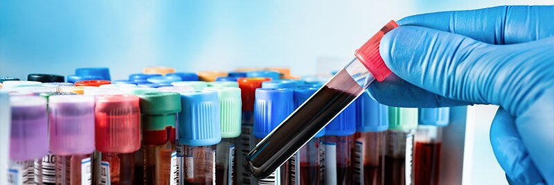 Clinical Microbiology Products