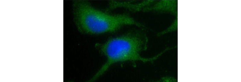 Nestin Rabbit anti-Human, Mouse, Rat, Polyclonal, Proteintech