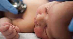 OSOM Bacterial Vaginosis Educational Brochure