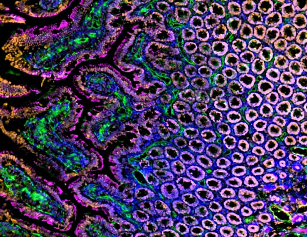 Immunofluorescent analysis of Sprague Dawley rat intestine, duodenum frozen sections with Histone H3 (orange), blood vessels (lectin, green), actin (magenta), and nuclei (blue) overlays Immunofluorescent analysis of Sprague Dawley rat intestine, duodenum frozen sections with Histone H3 (orange), blood vessels (lectin, green), actin (magenta), and nuclei (blue) overlays