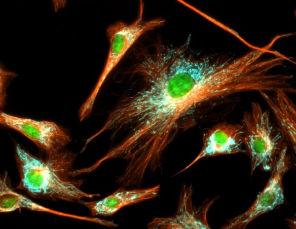 Immunofluorescent analysis of tubulin in BPAE cells with mitochondria (ATP synthase, cyan), tubulin (orange), and nuclei (green) overlays Immunofluorescent analysis of tubulin in BPAE cells with mitochondria (ATP synthase, cyan), tubulin (orange), and nuclei (green) overlays