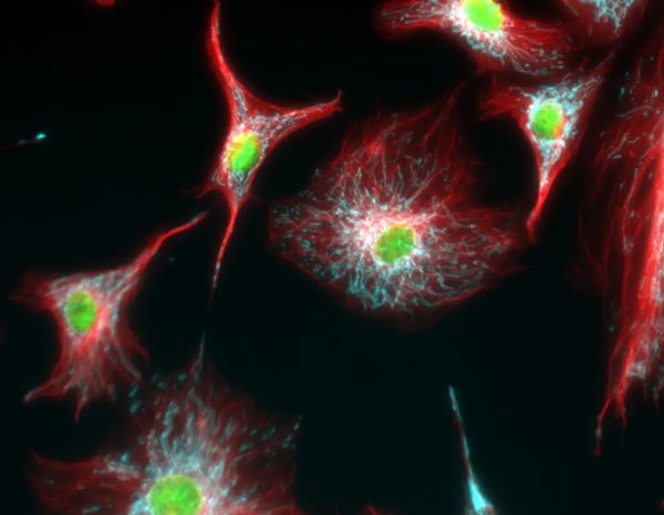 Immunofluorescent analysis of tubulin in BPAE cells with mitochondria (ATP synthase, cyan), tubulin (red) and nuclei (green) overlays Immunofluorescent analysis of tubulin in BPAE cells with mitochondria (ATP synthase, cyan), tubulin (red) and nuclei (green) overlays
